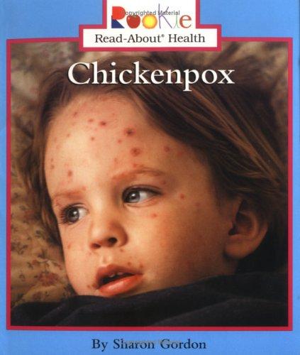 Chickenpox book cover