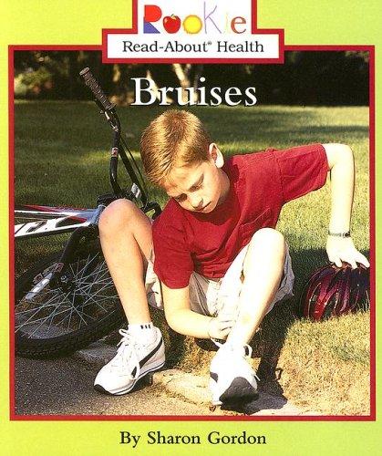 Bruises book cover