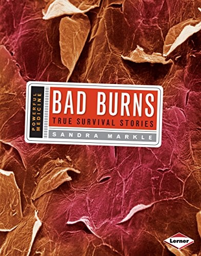 Bad Burns book cover